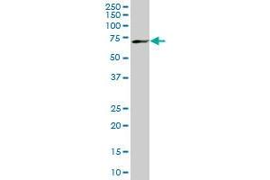 MBD1 monoclonal antibody (M02), clone 2C7.