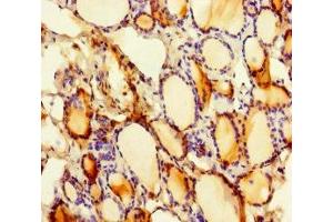 Immunohistochemistry of paraffin-embedded human thyroid tissue using ABIN7169807 at dilution of 1:100 (SLITRK6 anticorps  (AA 621-821))