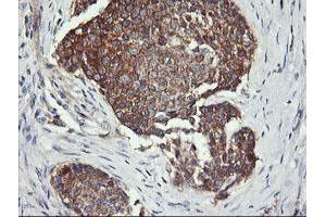 Image no. 3 for anti-Dynamin 1-Like (DNM1L) antibody (ABIN1497872)