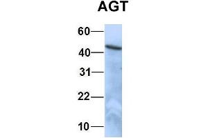 Host:  Rabbit  Target Name:  EGFL8  Sample Type:  HepG2  Antibody Dilution:  1.