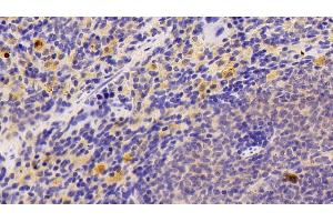 Detection of NFkB in Rat Spleen Tissue using Polyclonal Antibody to Nuclear Factor Kappa B (NFkB)