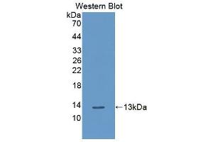 Western blot analysis of the recombinant protein. (PLXNB1 anticorps  (AA 581-727))