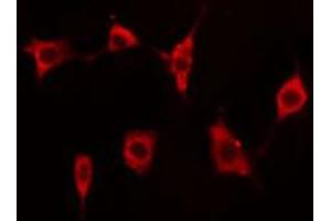 ABIN6273510 staining A549 cells by IF/ICC. (EIF4G2 anticorps  (N-Term))