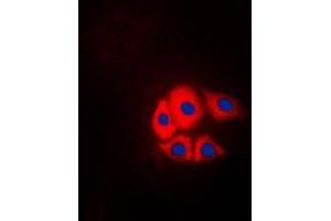 Immunofluorescent analysis of p130 Cas (pY249) staining in NIH3T3 cells.