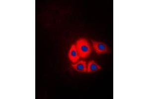 Immunofluorescent analysis of p130 Cas (pY249) staining in NIH3T3 cells. (BCAR1 anticorps  (pTyr249))