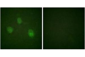 Immunofluorescence analysis of HeLa cells, using AurB (Ab-12) Antibody.