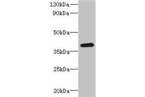 Western blot All lanes: RSPH14 antibody at 8 μg/mL + 293T whole cell lysate Secondary Goat polyclonal to rabbit IgG at 1/10000 dilution Predicted band size: 39 kDa Observed band size: 39 kDa (RTDR1 anticorps  (AA 1-230))