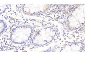 Detection of APOD in Human Colon Tissue using Polyclonal Antibody to Apolipoprotein D (APOD)