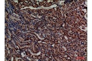 Immunohistochemistry (IHC) analysis of paraffin-embedded Rat Kidney, antibody was diluted at 1:100.