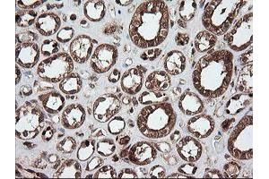 Image no. 4 for anti-Ubiquitin-Conjugating Enzyme E2G 2 (UBE2G2) antibody (ABIN1501634)