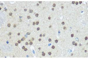 Immunohistochemistry of paraffin-embedded Mouse brain using UBA1 Polyclonal Antibody at dilution of 1:100 (40x lens). (UBA1 anticorps)
