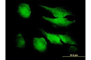 Immunofluorescence of purified MaxPab antibody to FGF1 on HeLa cell. (FGF1 anticorps  (AA 1-155))