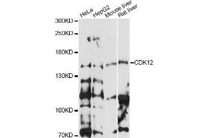 Western blot analysis of extracts of various cell lines, using CDK12 antibody (ABIN6291897) at 1:1000 dilution. (CDK12 anticorps)