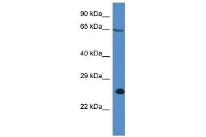 Western Blot showing ITPRIP antibody used at a concentration of 1 ug/ml against A549 Cell Lysate (ITPRIP anticorps  (C-Term))