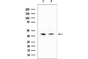 anti-Aldehyde Dehydrogenase 3 Family, Member B2 (ALDH3B2) (C-Term) antibody