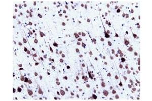 Immunohistochemistry (IHC) image for anti-Small Nuclear Ribonucleoprotein Polypeptide N (SNRPN) (AA 14-174) antibody (ABIN968086) (SNRPN anticorps  (AA 14-174))