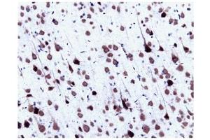 Immunohistochemistry (IHC) image for anti-Small Nuclear Ribonucleoprotein Polypeptide N (SNRPN) (AA 14-174) antibody (ABIN968086) (SNRPN anticorps  (AA 14-174))