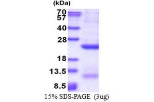 SDS-PAGE (SDS) image for Glypican 4 (GPC4) (AA 401-529) protein (His tag) (ABIN5853620)