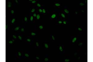 Immunofluorescence staining of Hela Cells with ABIN7127566 at 1:50, counter-stained with DAPI.