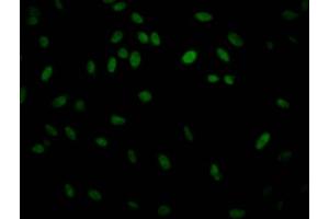 Immunofluorescence staining of Hela Cells with ABIN7127566 at 1:50, counter-stained with DAPI. (Recombinant IKBKB anticorps)
