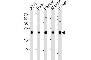 Western blot analysis of lysates from , Hela, HepG2 cell line, mouse brain and rat liver tissue lysate(from left to right), using IT Antibody (N-term) (ABIN651135 and ABIN2840091). (ITPA anticorps  (N-Term))