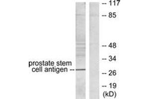 Western blot analysis of extracts from HepG2 cells, using Prostate Stem Cell Antigen Antibody. (PSCA anticorps  (AA 41-90))