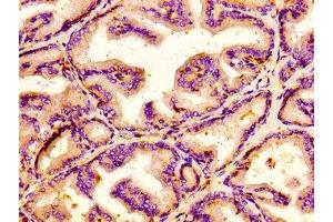 IHC image of ABIN7157162 diluted at 1:100 and staining in paraffin-embedded human prostate tissue performed on a Leica BondTM system.