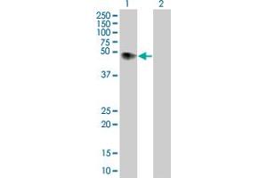 Lane 1: F2R transfected lysate ( 46.