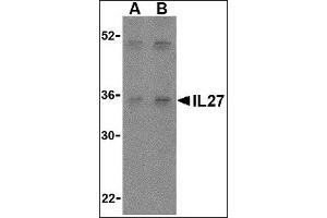 Image no. 2 for anti-Interleukin-27 Subunit alpha (IL27) (Center) antibody (ABIN372920) (IL27 anticorps  (Center))