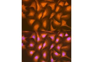 Immunofluorescence analysis of U-2 OS cells using HSP Rabbit mAb (ABIN7267579) at dilution of 1:100 (40x lens).