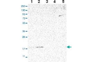Western blot analysis of Lane 1: RT-4 Lane 2: U-251 MG Lane 3: Human Plasma Lane 4: Liver Lane 5: Tonsil with MRPS24 polyclonal antibody ( Cat # PAB28022 ) at 1:100 - 1:250 dilution. (MRPS24 anticorps)