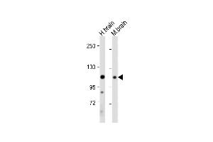 All lanes : Anti-EphA4 Antibody (C-term) at 1:2000 dilution Lane 1: Human brain tissue lysate Lane 2: Mouse brain tissue lysate Lysates/proteins at 20 μg per lane.
