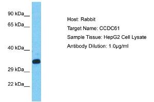 Host: Rabbit Target Name: CCDC61 Sample Type: HepG2 Whole Cell lysates Antibody Dilution: 1. (CCDC61 anticorps  (C-Term))