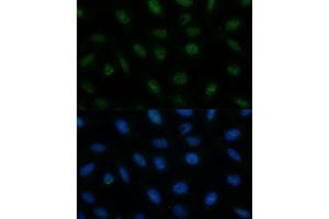 Immunofluorescence analysis of U-2 OS cells using CENPA Polyclonal Antibody (ABIN7266271) at dilution of 1:100 (40x lens).