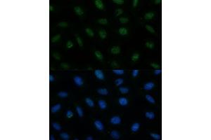Immunofluorescence analysis of U-2 OS cells using CENPA Polyclonal Antibody (ABIN7266271) at dilution of 1:100 (40x lens). (CENPA anticorps  (AA 1-100))