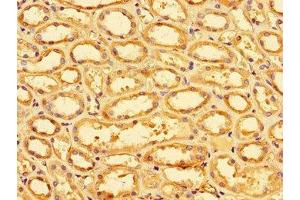 Immunohistochemistry of paraffin-embedded human kidney tissue using ABIN7170023 at dilution of 1:100 (SLC9A1 anticorps  (AA 36-102))