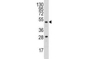 Western blot analysis of Urokinase antibody and A2058 lysate (PLAU anticorps  (AA 60-90))