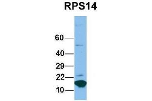 Host:  Rabbit  Target Name:  RPS14  Sample Type:  Hela  Antibody Dilution:  1. (RPS14 anticorps  (Middle Region))