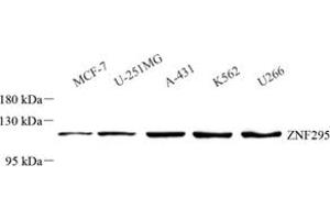 Western blot analysis of ZNF295 (ABIN7076264) at dilution of 1: 500 (ZNF295 anticorps)
