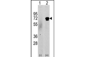 Western blot analysis of CKK2 (arrow) using rabbit polyclonal CKK2 Antibody (N-term G67) (ABIN391182 and ABIN2841279). (CAMKK2 anticorps  (N-Term))