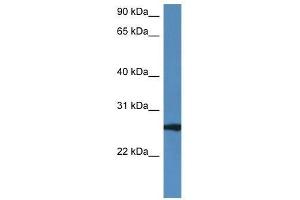 Western Blot showing Rab27b antibody used at a concentration of 1. (RAB27B anticorps  (C-Term))