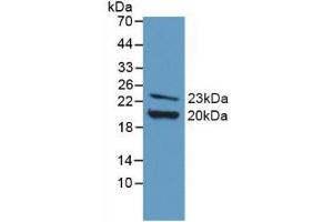Detection of Recombinant FGF2, Mouse using Polyclonal Antibody to Fibroblast Growth Factor 2, Basic (FGF2) (FGF2 anticorps  (AA 10-154))
