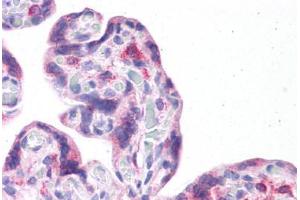 Human Placenta: Formalin-Fixed, Paraffin-Embedded (FFPE)