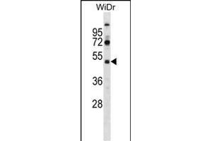 SUPT7L Antibody (Center) (ABIN1537989 and ABIN2848712) western blot analysis in WiDr cell line lysates (35 μg/lane). (SUPT7L anticorps  (AA 186-214))