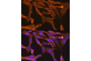 Immunofluorescence analysis of NIH-3T3 cells using TBK1/NAK Rabbit mAb (ABIN7270723) at dilution of 1:100 (40x lens).