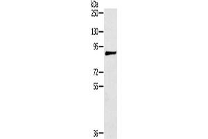 Gel: 6 % SDS-PAGE, Lysate: 40 μg, Lane: 293T cells, Primary antibody: ABIN7191356(MAGEE1 Antibody) at dilution 1/200, Secondary antibody: Goat anti rabbit IgG at 1/8000 dilution, Exposure time: 5 minutes (MAGEE1 anticorps)