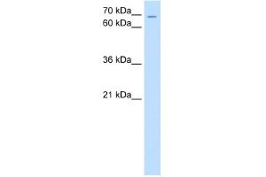 WB Suggested Anti-ZNF131 Antibody Titration:  0. (ZNF131 anticorps  (N-Term))