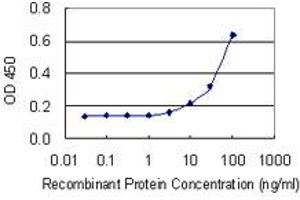 anti-Zinc Finger and BTB Domain Containing 7A (ZBTB7A) (AA 1-108) antibody