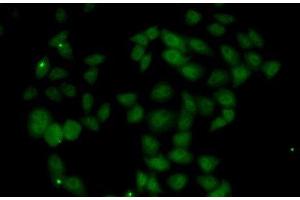 Immunofluorescence analysis of U2OS cells using FGF14 Polyclonal Antibody (FGF14 anticorps)