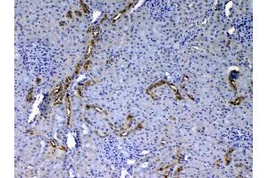 IHC analysis of EGF using anti-EGF antibody .